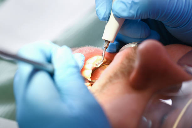Best Emergency Root Canal Therapy in Hallsville, TX